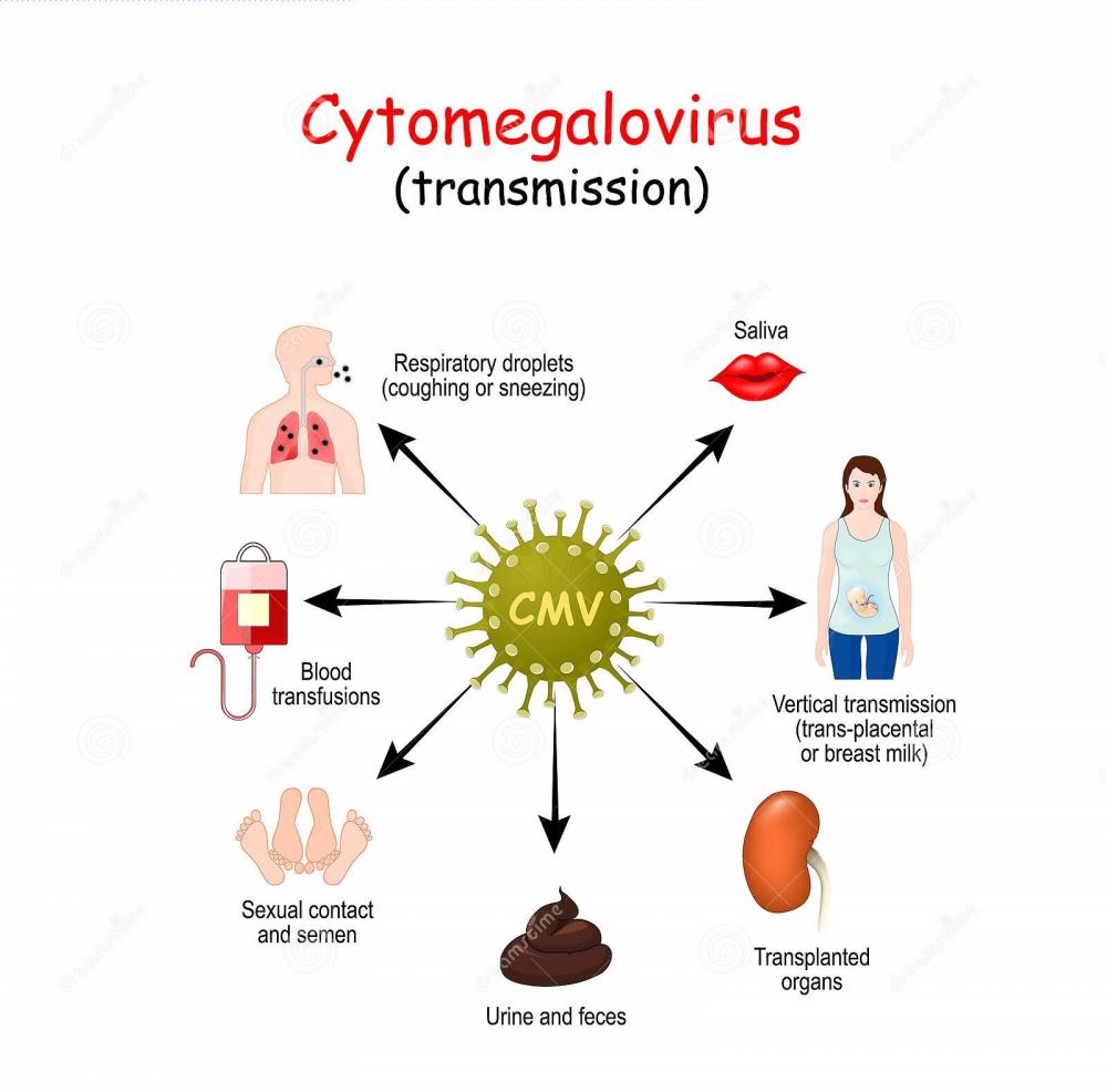 Nhiễm Cytomegalovirus ở bệnh nhân HIV và cách điều trị?